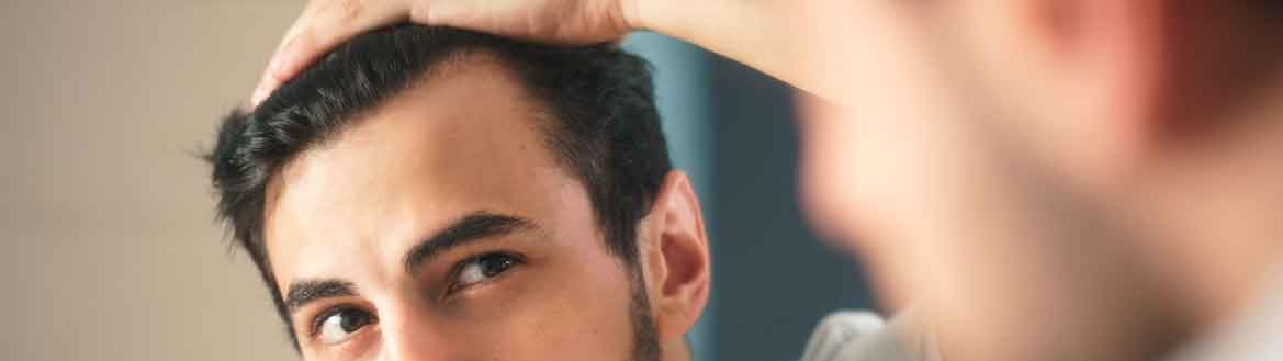 Homem jovem de frente para o espelho analisando o couro cabeludo por conta da queda de cabelo
